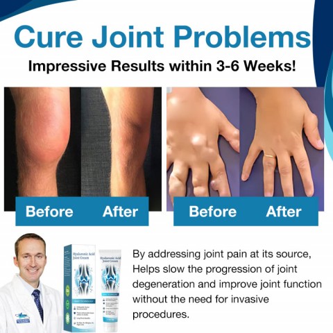 Hyaluronic Acid Joint Repair Cream