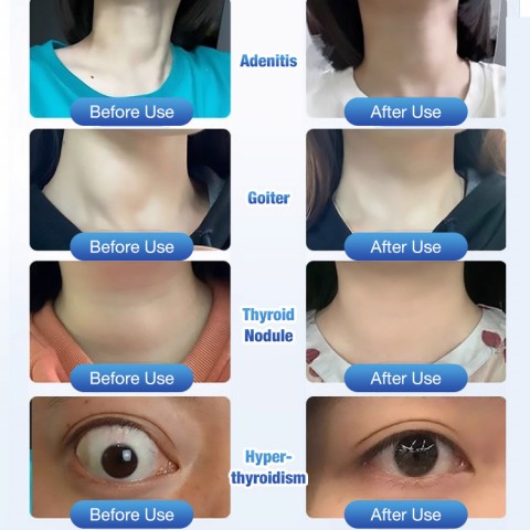Japanese Senjoko Thyroid Support Cream