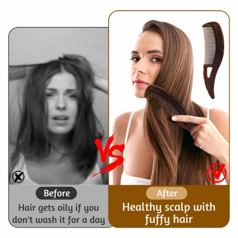 Wash-Free Hair and Dandruff-Free Massage Comb