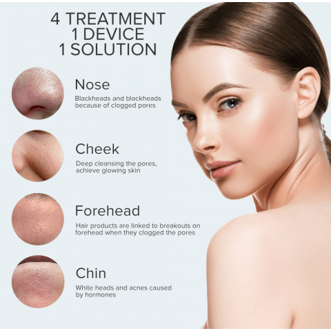 Ultrasonic facial pore deep cleaning beauty instrument remove black headed dead skin artifact