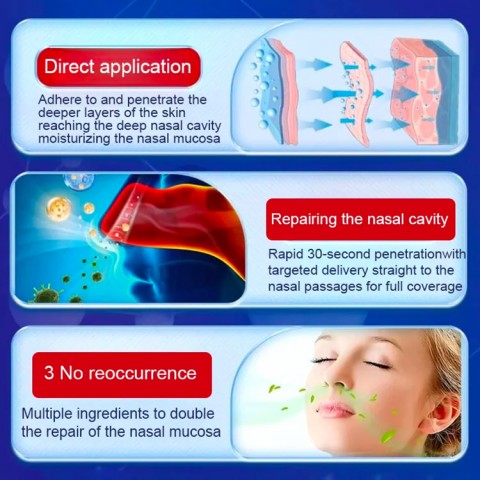 Acupuncture Point Rhinitis Relief Patches