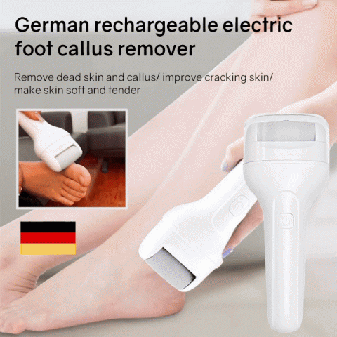 Portable electric foot callus remover
