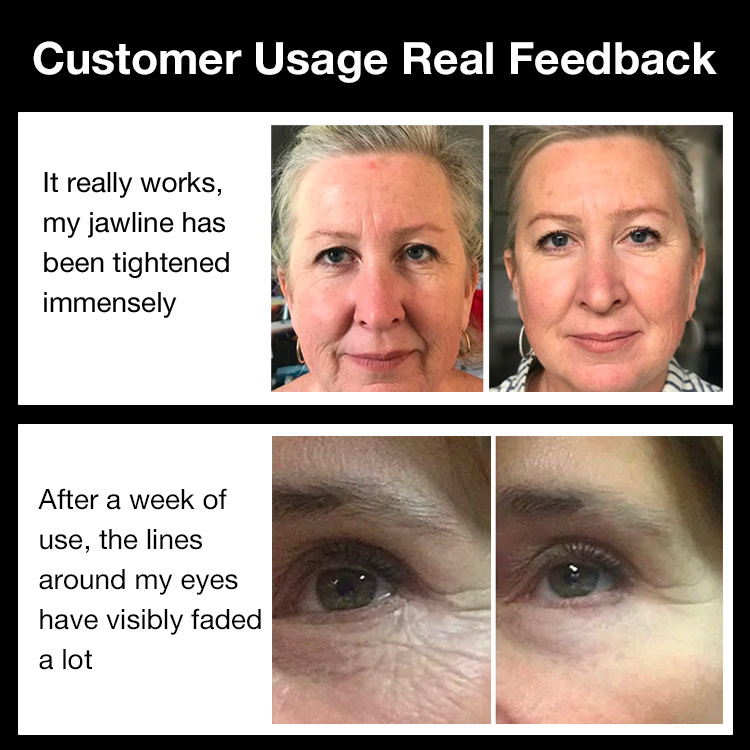 8-3 International Queens Day Sale to save 59p - 100% legit,one year warranty-Skin Lifting & Firming Massage Wrinkle Remove V Face Therapy Beauty Device-Buy Now Get Free Matching Cream